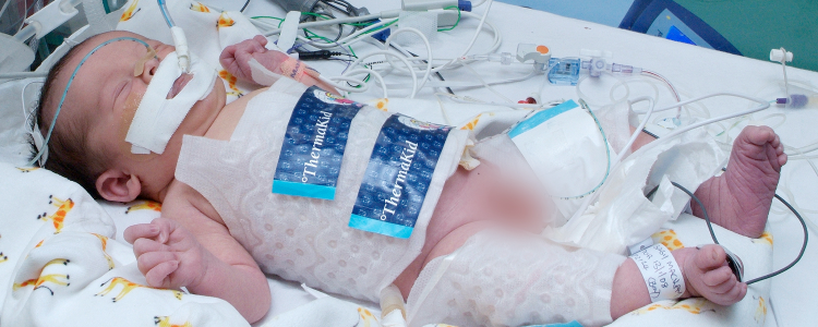 New neonatal cooling education resources for better treatment of babies suffering a lack of oxygen during birth image New neonatal cooling education resources for better treatment of babies suffering a lack of oxygen during birth